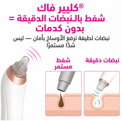 مجموعة إزالة الرؤوس السوداء من NouraBeauty